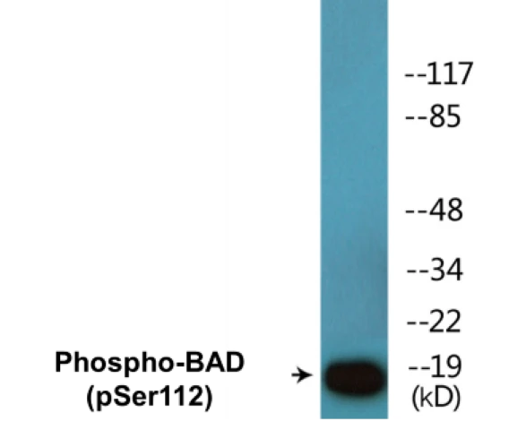 BAD (phospho Ser112) Cell Based ELISA Kit (A102437-296)