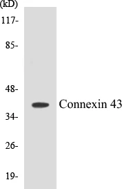 Connexin 43 Cell Based ELISA Kit (A102863-96)