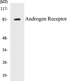 Androgen Receptor Cell Based ELISA Kit (A103609-96)