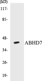 ABHD7 Cell Based ELISA Kit (A103432-96)