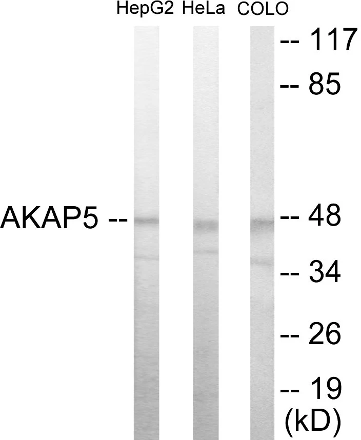 AKAP5 Cell Based ELISA Kit (A103692-96)