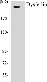 Dysferlin Cell Based ELISA Kit (A103382-96)