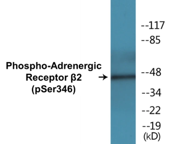 Adrenergic Receptor beta 2 (phospho Ser346) Cell Based ELISA Kit (A102702-296)