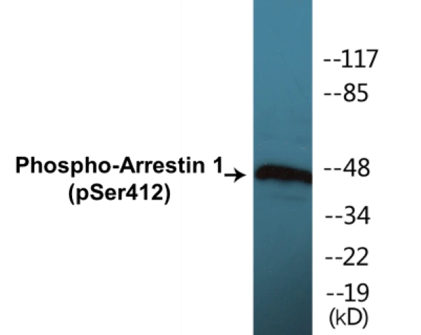 Arrestin 1 (phospho Ser412) Cell Based ELISA Kit (A102771-296)