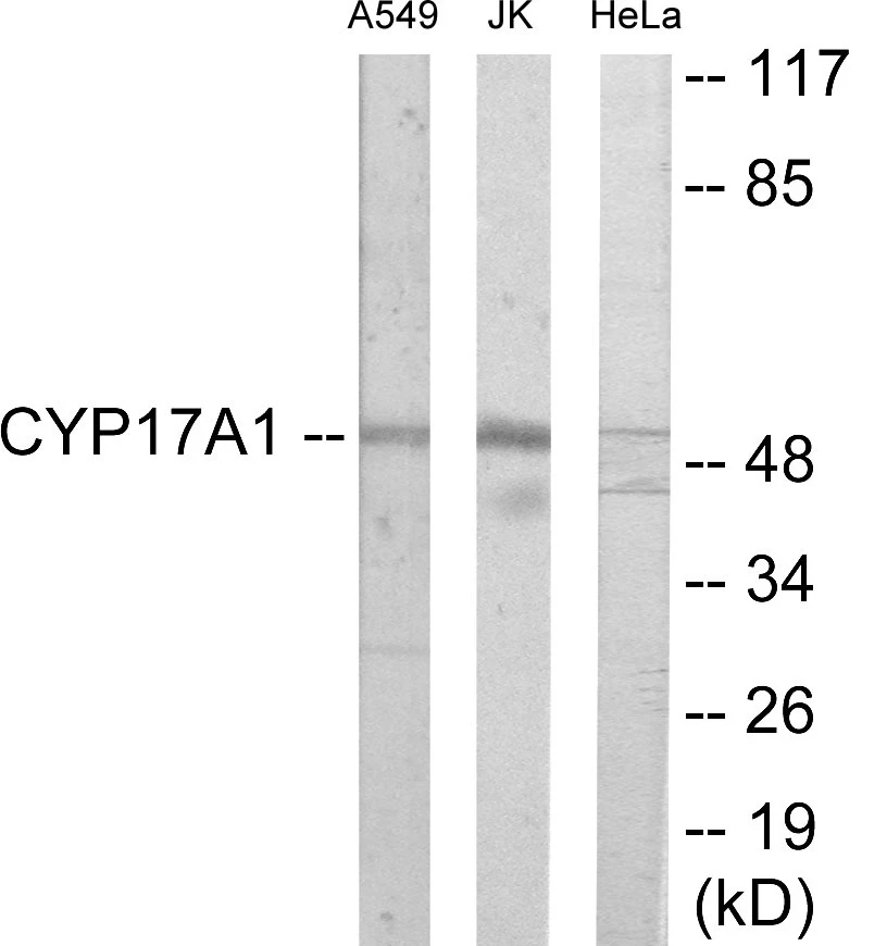 Cytochrome P45 017A1 Cell Based ELISA Kit (A103595-96)