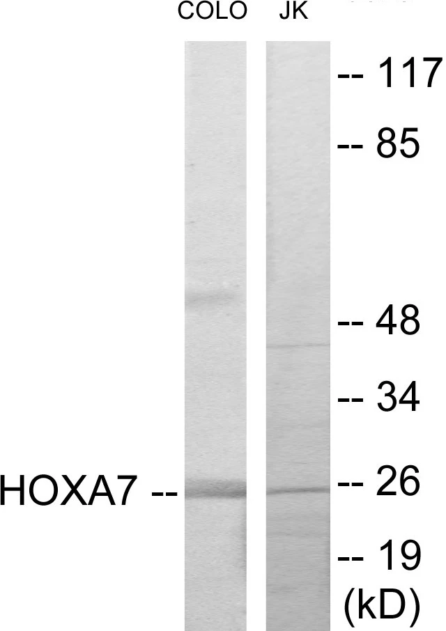 HOXA7 Cell Based ELISA Kit (A103143-96)