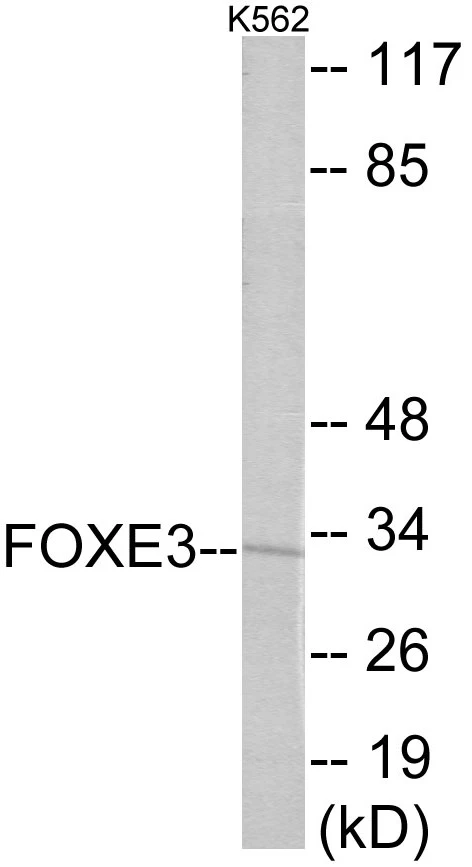 FOXE3 Cell Based ELISA Kit (A103162-96)