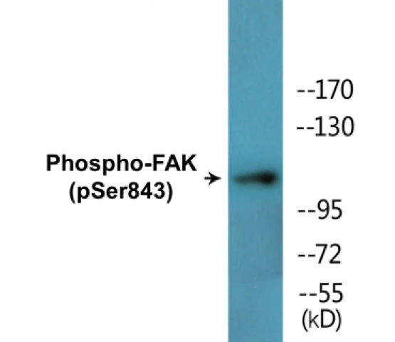 FAK (phospho Ser843) Cell Based ELISA Kit (A102447-296)