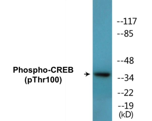 CREB (phospho Thr100) Cell Based ELISA Kit (A102344-296)