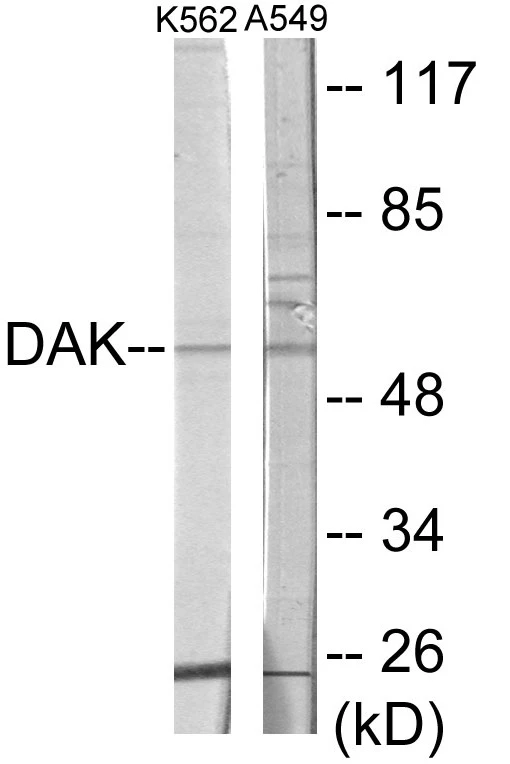 DAK Cell Based ELISA Kit (A103345-96)