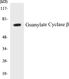 Guanylate Cyclase beta Cell Based ELISA Kit (A102796-96)