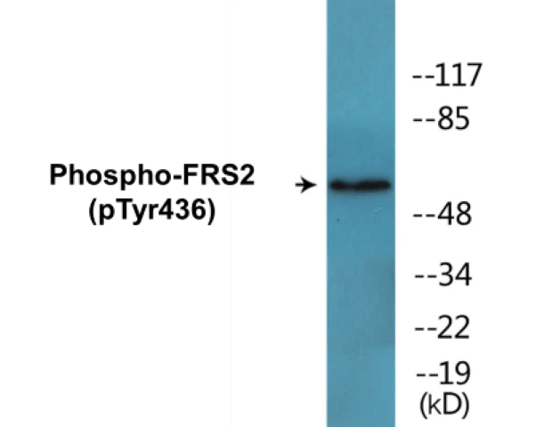 FRS2 (phospho Tyr436) Cell Based ELISA Kit (A102642-296)