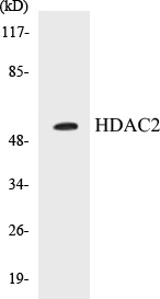 HDAC2 Cell Based ELISA Kit (A103042-96)