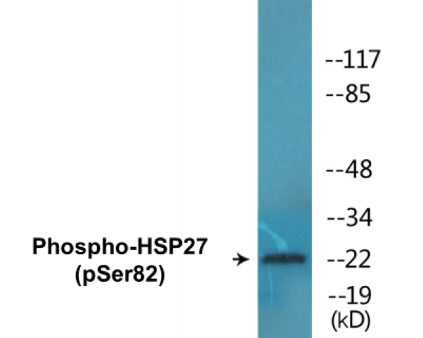 HSP27 (phospho Ser82) Cell Based ELISA Kit (A102254-296)