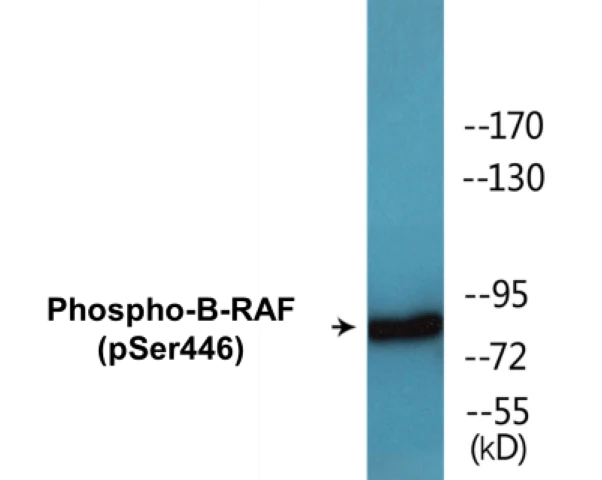 B-RAF (phospho Ser446) Cell Based ELISA Kit (A102632-296)