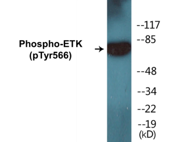 ETK (phospho Tyr566) Cell Based ELISA Kit (A103826-296)