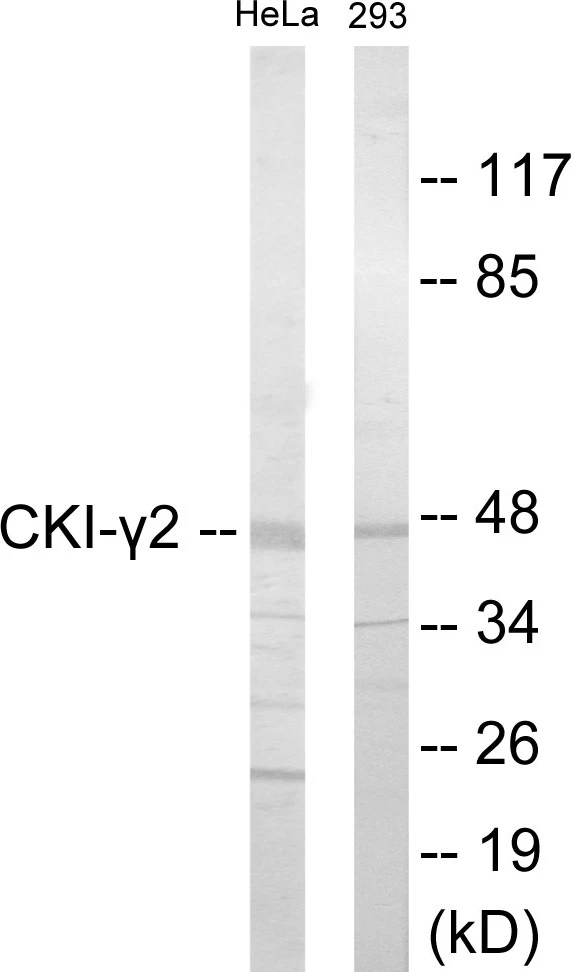 CKI gamma 2 Cell Based ELISA Kit (A102870-96)