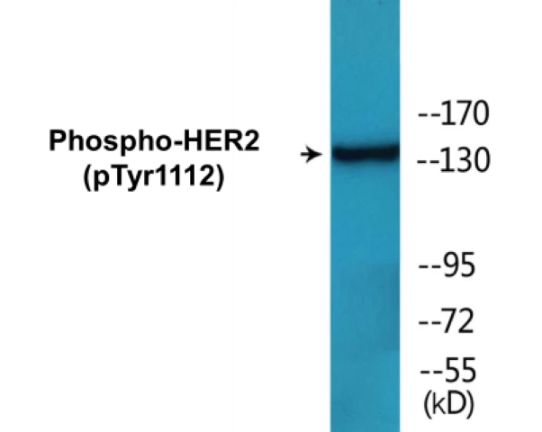 HER2 (phospho Tyr1112) Cell Based ELISA Kit (A102214-296)