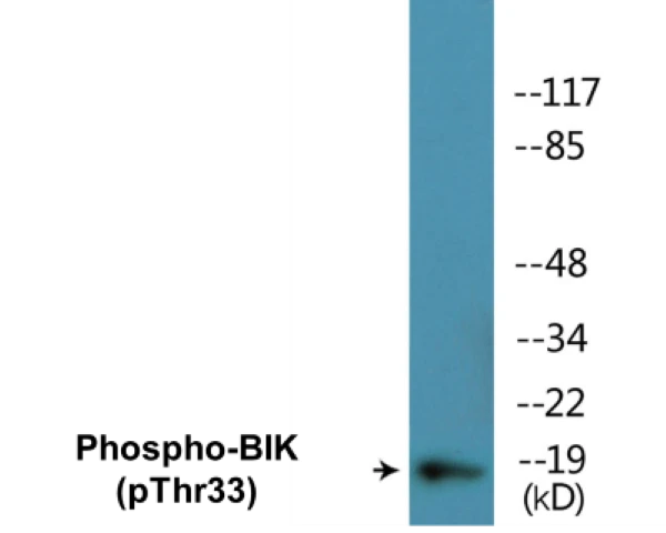 BIK (phospho Thr33) Cell Based ELISA Kit (A102761-296)