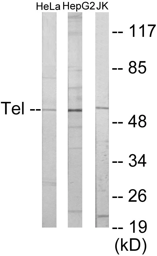 ETV6 Cell Based ELISA Kit (A103283-96)