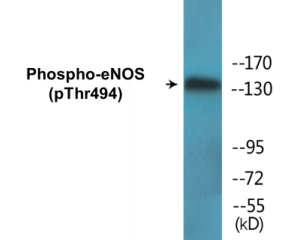 eNOS (phospho Thr494) Cell Based ELISA Kit (A102261-296)