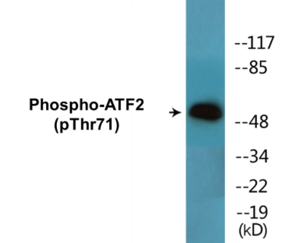 ATF2 (phospho Thr71) Cell Based ELISA Kit (A102434-296)