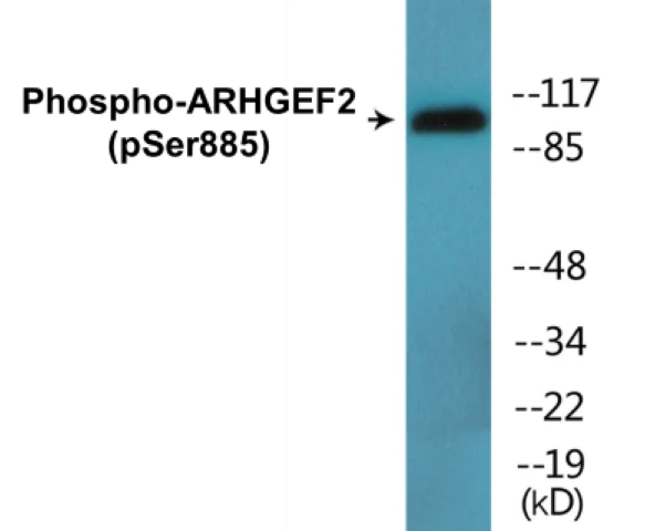 ARHGEF2 (phospho Ser885) Cell Based ELISA Kit (A102057-296)