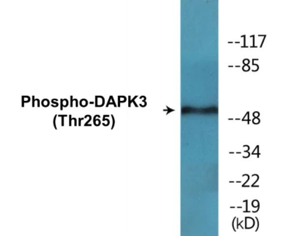 DAPK3 (phospho Thr265) Cell Based ELISA Kit (A102180-296)