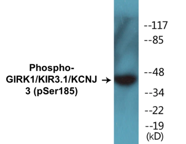 GIRK1 (phospho Ser185) Cell Based ELISA Kit (A102189-296)