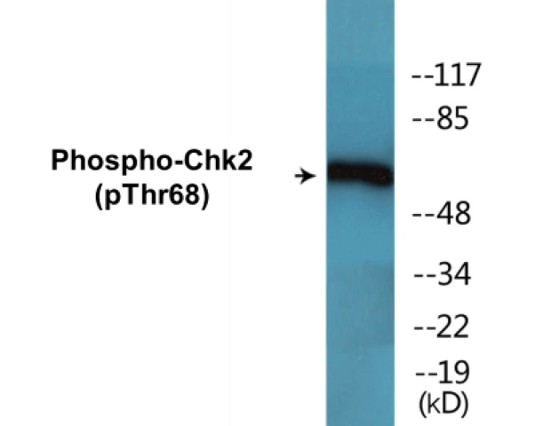 Chk2 (phospho Thr68) Cell Based ELISA Kit (A102403-296)