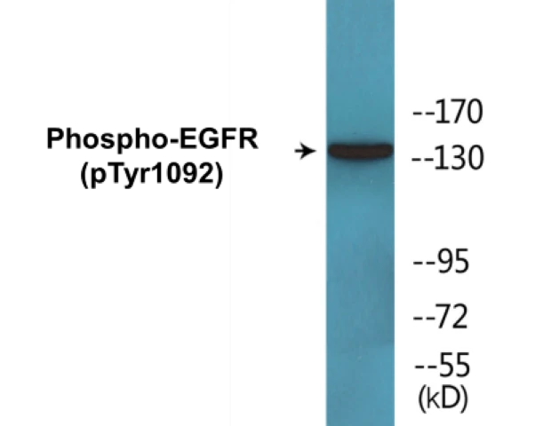 EGFR (phospho Tyr1092) Cell Based ELISA Kit (A102197-296)