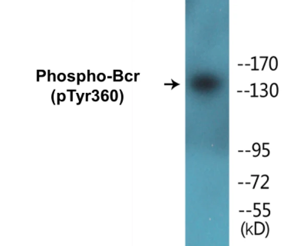 Bcr (phospho Tyr360) Cell Based ELISA Kit (A102670-296)