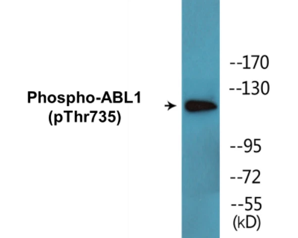 ABL1 (phospho Thr735) Cell Based ELISA Kit (A102347-296)