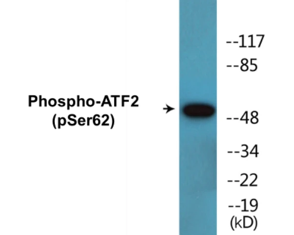 ATF2 (phospho Ser62) Cell Based ELISA Kit (A102401-296)