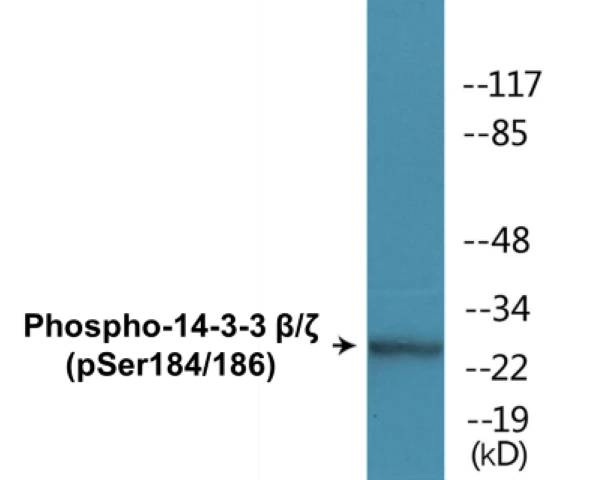 14-3-3 beta + zeta (phospho Ser184 + Ser186) Cell Based ELISA Kit (A102227-296)