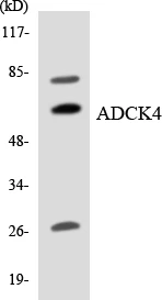 ADCK4 Cell Based ELISA Kit (A103174-96)