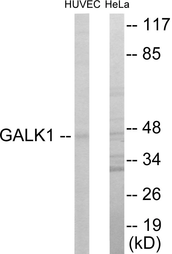 GALK1 Cell Based ELISA Kit (A103150-96)