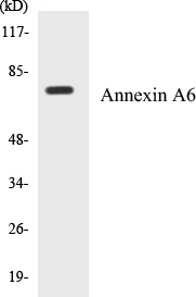 Annexin A6 Cell Based ELISA Kit (A103624-96)