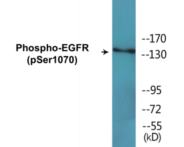 EGFR (phospho Ser1070) Cell Based ELISA Kit (A102196-296)