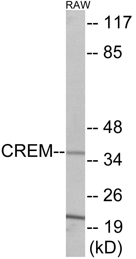 CREM Cell Based ELISA Kit (A103289-96)