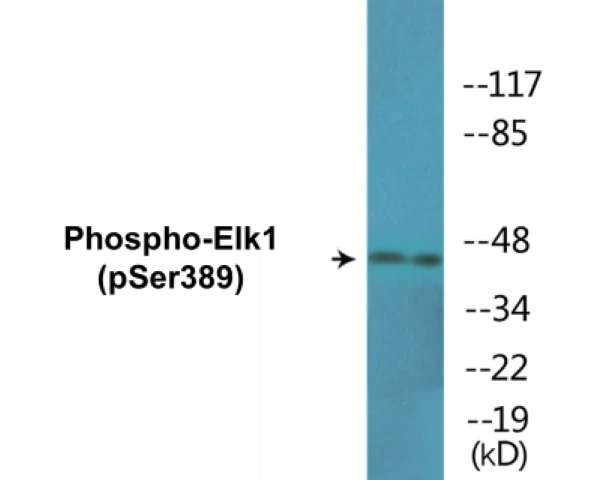 Elk1 (phospho Ser389) Cell Based ELISA Kit (A102279-296)