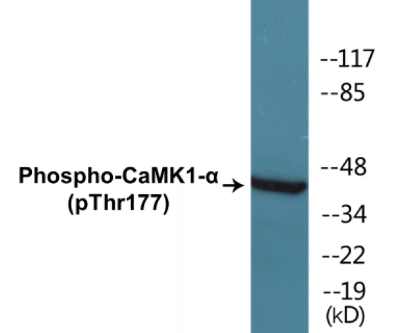 CaMK1 alpha (phospho Thr177) Cell Based ELISA Kit (A102502-296)