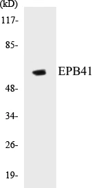 EPB41 Cell Based ELISA Kit (A103437-96)