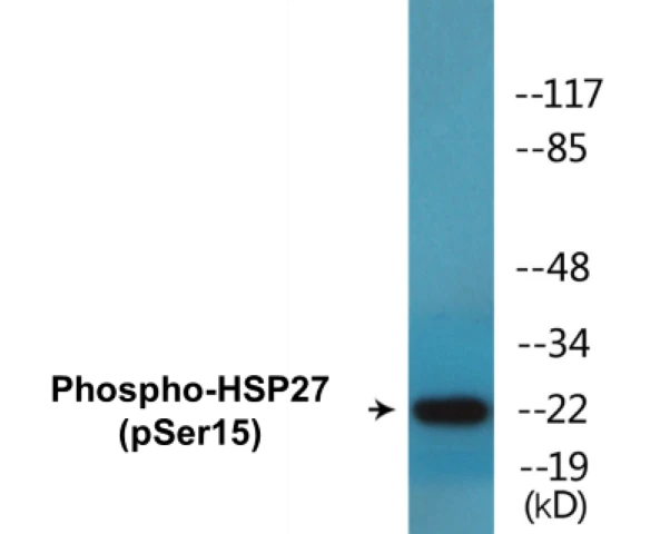 HSP27 (phospho Ser15) Cell Based ELISA Kit (A102743-296)