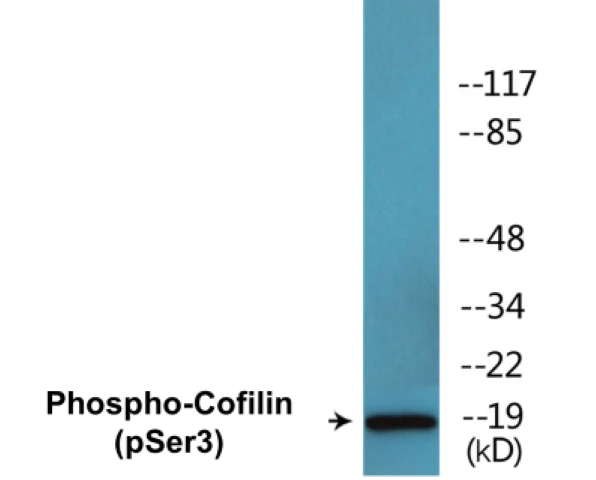 Cofilin (phospho Ser3) Cell Based ELISA Kit (A102132-296)