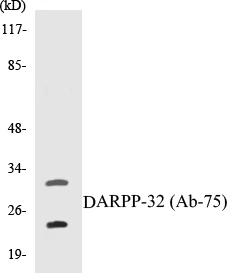 DARPP-32 Cell Based ELISA Kit (A102956-96)