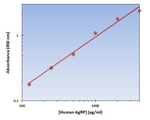 Human AgRP ELISA Kit (A102028-96)