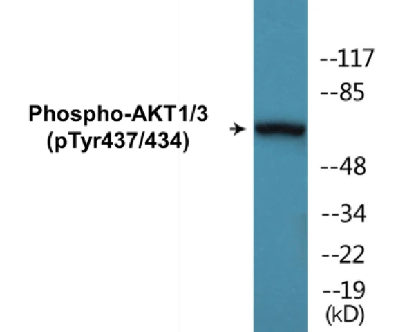 AKT1 + 3 (phospho Tyr437 + Tyr434) Cell Based ELISA Kit (A102072-296)