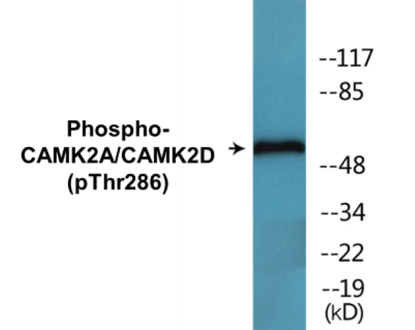 CAMK2A + CAMK2D (phospho Thr286) Cell Based ELISA Kit (A102236-296)