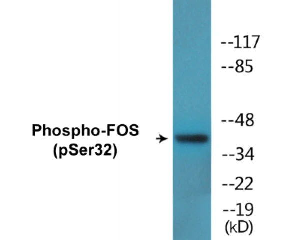 FOS (phospho Ser32) Cell Based ELISA Kit (A102478-296)